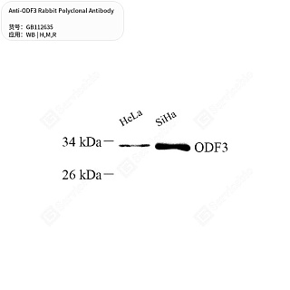 Антитела первичные, поликлональные кролика к ODF3 крысы, мыши, человека, 50 мкл