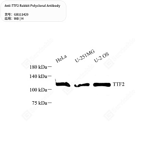 Антитела первичные, поликлональные кролика к TTF2 человека, 50 мкл