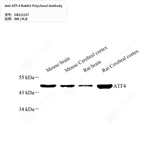 Антитела первичные, поликлональные кролика к ATF-4 крысы, мыши, 50 мкл