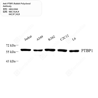 Антитела первичные, поликлональные кролика к PTBP1 крысы, мыши, человека, 50 мкл