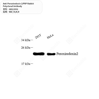 Антитела первичные, поликлональные кролика к Peroxiredoxin 2/PRP крысы, мыши, человека, 50 мкл
