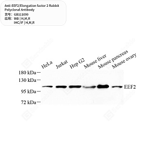 Антитела первичные, поликлональные кролика к EEF2/Elongation factor 2 крысы, мыши, человека, 50 мкл