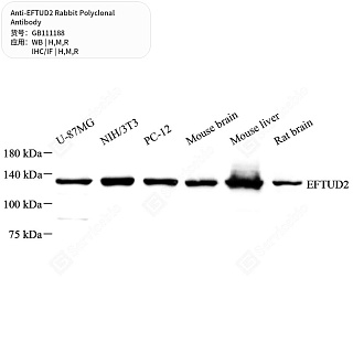 Антитела первичные, поликлональные кролика к EFTUD2 крысы, мыши, человека, 50 мкл