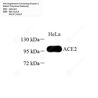 Антитела первичные, пол. кролика к Angiotensin Converting Enzyme 2 крысы, мыши, человека, 100 мкл