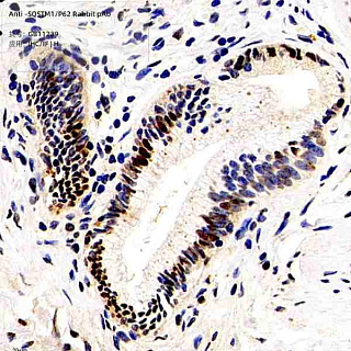 Антитела первичные, поликлональные кролика к SQSTM1/p62 человека, 100 мкл