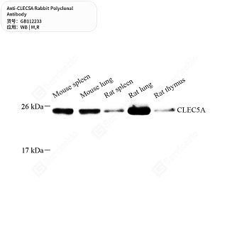 Антитела первичные, поликлональные кролика к CLEC5A крысы, мыши, 50 мкл