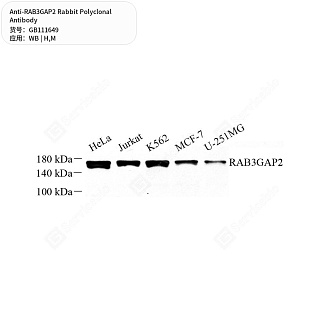 Антитела первичные, поликлональные кролика к RAB3GAP2 мыши, человека, 50 мкл