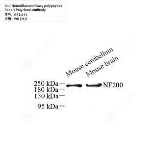 Антитела первичные, поликлональные кролика к Neurofilament heavy polypeptide крысы, мыши, 50 мкл