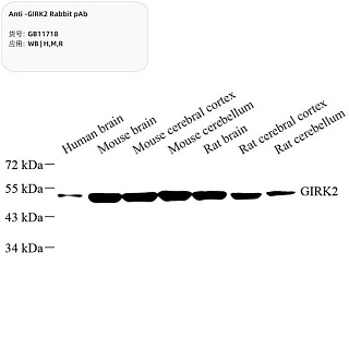 Антитела первичные, поликлональные кролика к GIRK2 крысы, мыши, человека, 100 мкл
