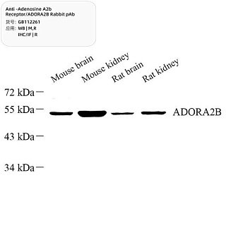 Антитела первичные, поликлональные кролика к Adenosine A2b Receptor/ADORA2B крысы, мыши, 100 мкл