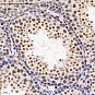 Антитела первичные, поликлональные, splicing factor 1, 100 мкл