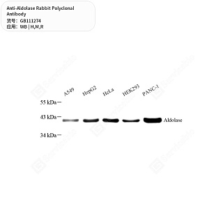 Антитела первичные, поликлональные кролика к Aldolase крысы, мыши, человека, 50 мкл