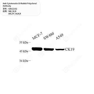 Антитела первичные, поликлональные кролика к Cytokeratin 19 крысы, мыши, человека, 50 мкл