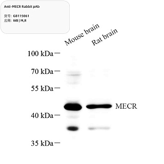 Антитела первичные, поликлональные кролика к MECR крысы, мыши, 100 мкл