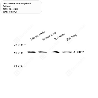 Антитела первичные, поликлональные кролика к ABHD2 крысы, мыши, 50 мкл