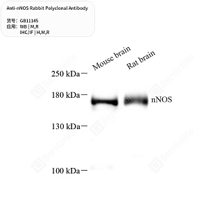 Антитела первичные, поликлональные кролика к nNOS крысы, мыши, человека, 50 мкл