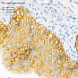 Антитела первичные, поликлональные, Cytokeratin 5, 100 мкл
