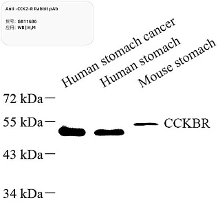 Антитела первичные, поликлональные кролика к CCK2-R мыши, человека, 100 мкл