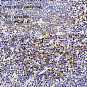Антитела первичные, поликлональные, ATG7, 100 мкл
