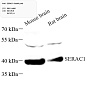 Антитела первичные, поликлональные, SERAC1, 100 мкл