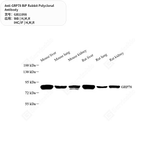 Антитела первичные, поликлональные кролика к GRP78 BiP крысы, мыши, человека, 50 мкл