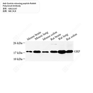 Антитела первичные, поликлональные кролика к Gastrin releasing peptide крысы, мыши, 50 мкл