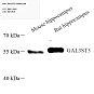 Антитела первичные, поликлональные, GAL3ST3, 100 мкл
