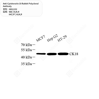 Антитела первичные, поликлональные кролика к Cytokeratin 18 крысы, мыши, человека, 50 мкл