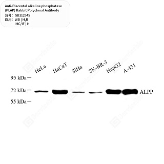 Антитела первичные, поликл. кролика к Placental alkaline phosphatase (PLAP) крысы, человека, 50 мкл