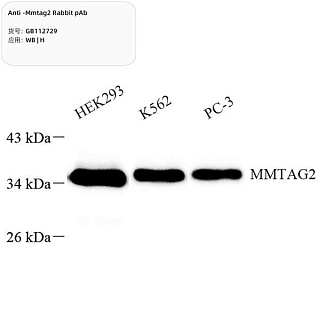 Антитела первичные, поликлональные кролика к Mmtag2 человека, 100 мкл