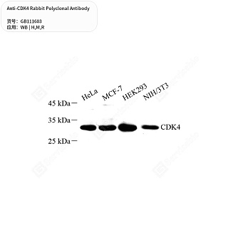 Антитела первичные, поликлональные кролика к CDK4 крысы, мыши, человека, 50 мкл