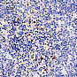 Антитела первичные, поликлональные, CXCR1, 100 мкл
