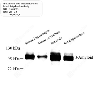 Антитела первичные, поликлональные кролика к Amyloid beta precursor protein крысы, мыши, 50 мкл