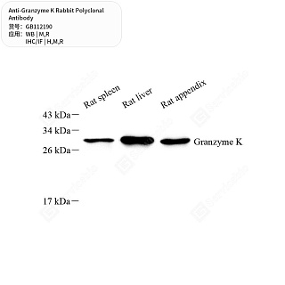 Антитела первичные, поликлональные кролика к Granzyme K крысы, мыши, человека, 50 мкл