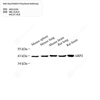 Антитела первичные, поликлональные кролика к Arp2 крысы, мыши, человека, 50 мкл