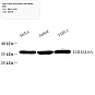Антитела первичные, поликлональные, LDHA-like protein 6A, 100 мкл