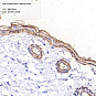 Антитела первичные, моноклональные, Cytokeratin 6, 100 мкл