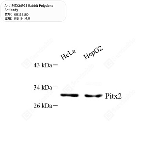 Антитела первичные, поликлональные кролика к PITX2/RGS крысы, мыши, человека, 50 мкл