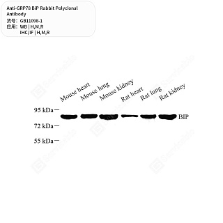 Антитела первичные, поликлональные кролика к GRP78 BiP крысы, мыши, человека, 50 мкл