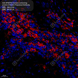 Антитела первичные, поликлональные кролика к BTB/POZ domain-containing protein 6 человека, 50 мкл