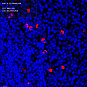 Антитела первичные, поликлональные, IL-22, 100 мкл
