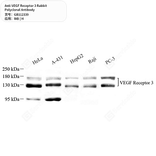 Антитела первичные, поликлональные кролика к VEGF Receptor 3 человека, 50 мкл
