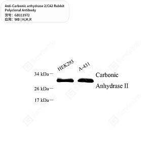 Антитела первичные, поликлональные кролика к Carbonic anhydrase 2/CA2 крысы, мыши, человека, 50 мкл