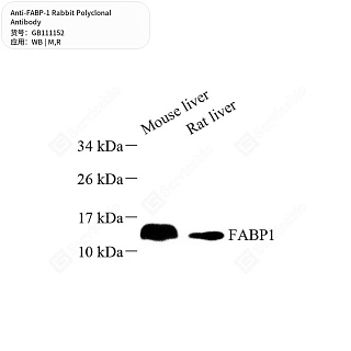 Антитела первичные, поликлональные кролика к FABP-1 крысы, мыши, 50 мкл