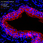 Антитела первичные, поликлональные, Cytokeratin 5, 100 мкл