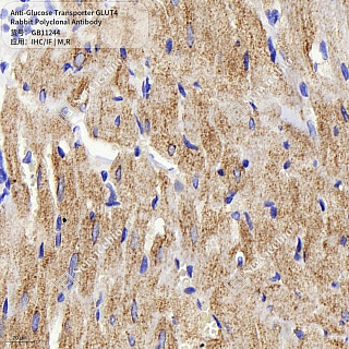 Антитела первичные, поликлональные кролика к Glucose Transporter GLUT4 крысы, мыши, 50 мкл