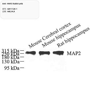 Антитела первичные, поликлональные кролика к MAP2 крысы, мыши, 100 мкл