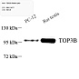 Антитела первичные, поликлональные, TOP3B, 100 мкл