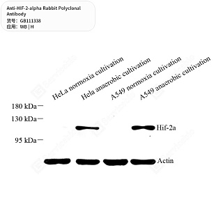 Антитела первичные, поликлональные кролика к HIF-2-alpha человека, 50 мкл