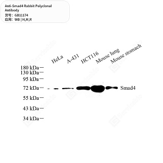 Антитела первичные, поликлональные кролика к Smad4 крысы, мыши, человека, 50 мкл